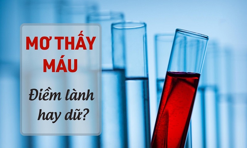 Mơ thấy máu đỏ thể hiện điều gì?